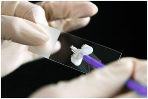 Pap test e prevenzione per il cancro